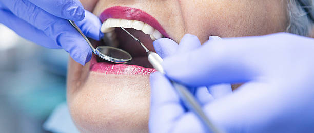 Best Broken or Chipped Tooth Repair in Awendaw, SC